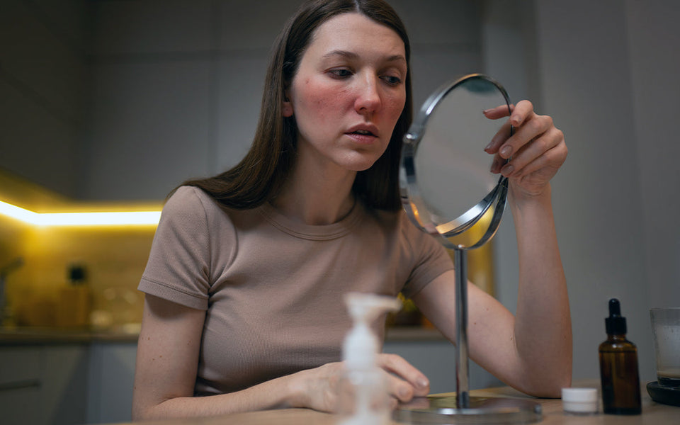 Is Your Gut Causing Your Hormonal Acne and What Can You Do About It?